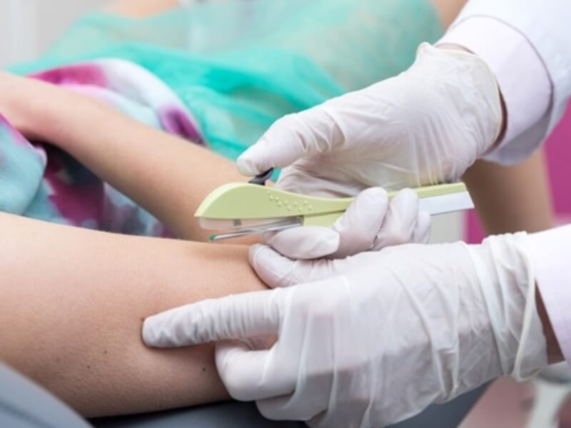 Anvisa amplia eficácia de implante contraceptivo para cinco anos soaquinoticias